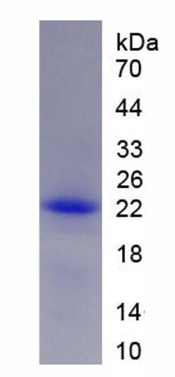 Human Recombinant Matrix Metalloproteinase 3 (MMP3)