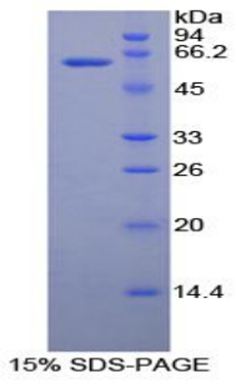 Human Recombinant Ribonuclease T2 (RNASET2)