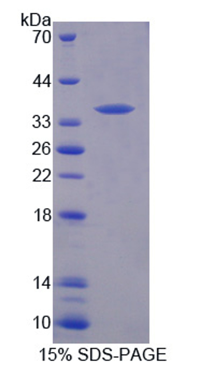 Mouse Recombinant Tyrosine Kinase With ImMunoglobulin Like And EGF Like Domains Protein 1 (Tie1)