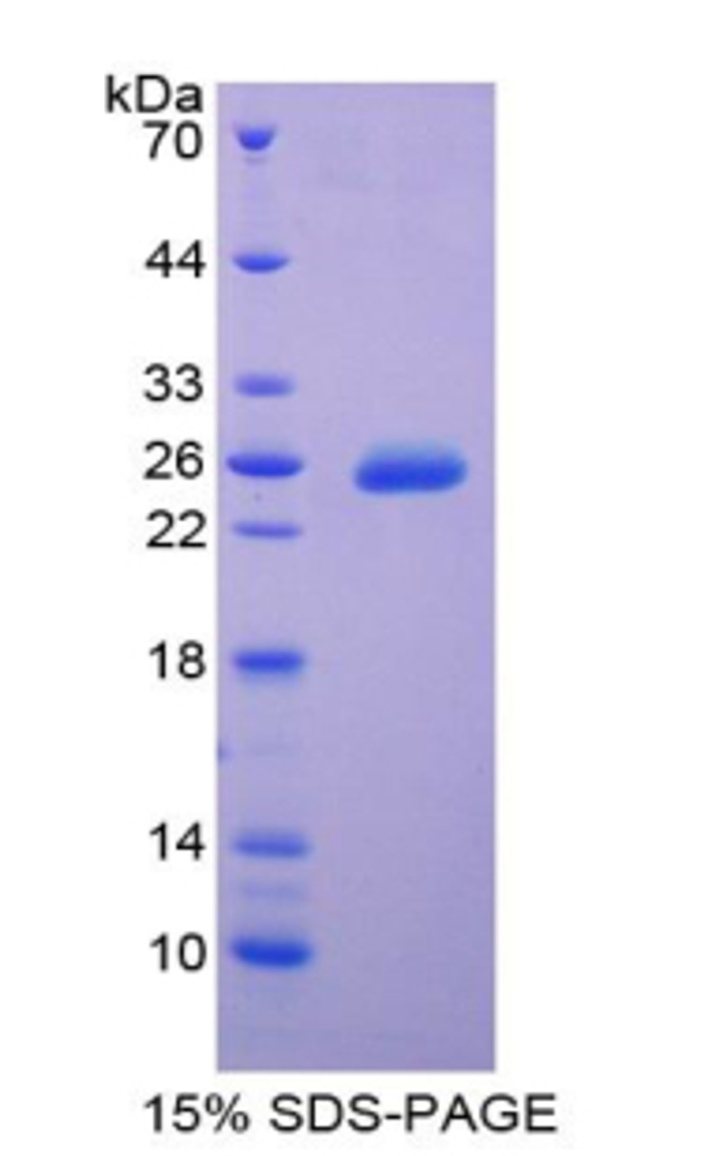 Cattle Recombinant Tissue Inhibitors Of Metalloproteinase 3 (TIMP3)