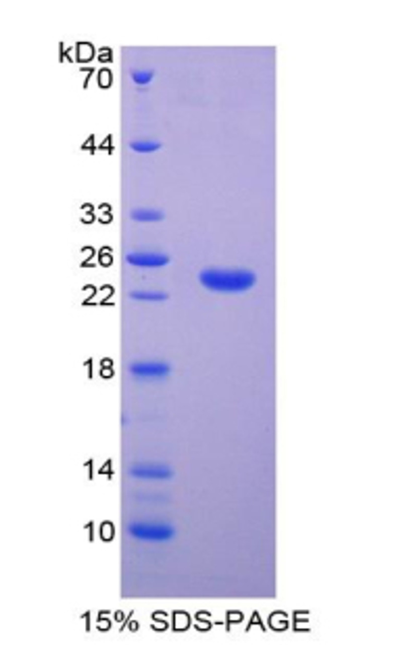 Cattle Recombinant Tissue Inhibitors Of Metalloproteinase 4 (TIMP4)