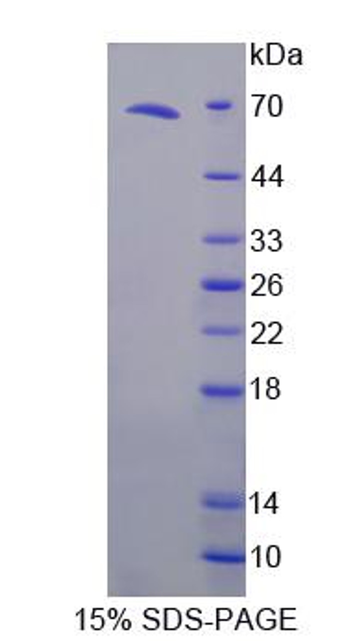 Human Recombinant Tumor Necrosis Factor Receptor Superfamily, Member 10C (TNFRSF10C)