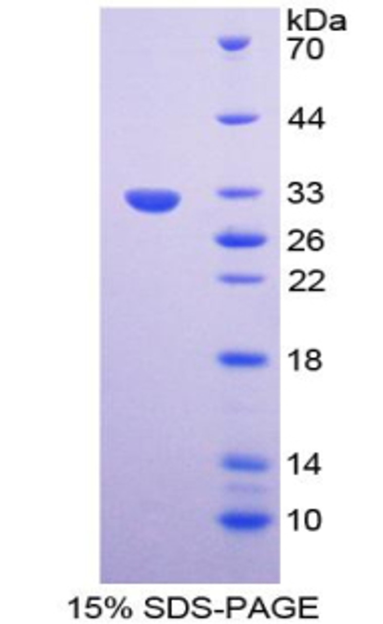 Mouse Recombinant Plasminogen Activator, Urokinase (uPA)