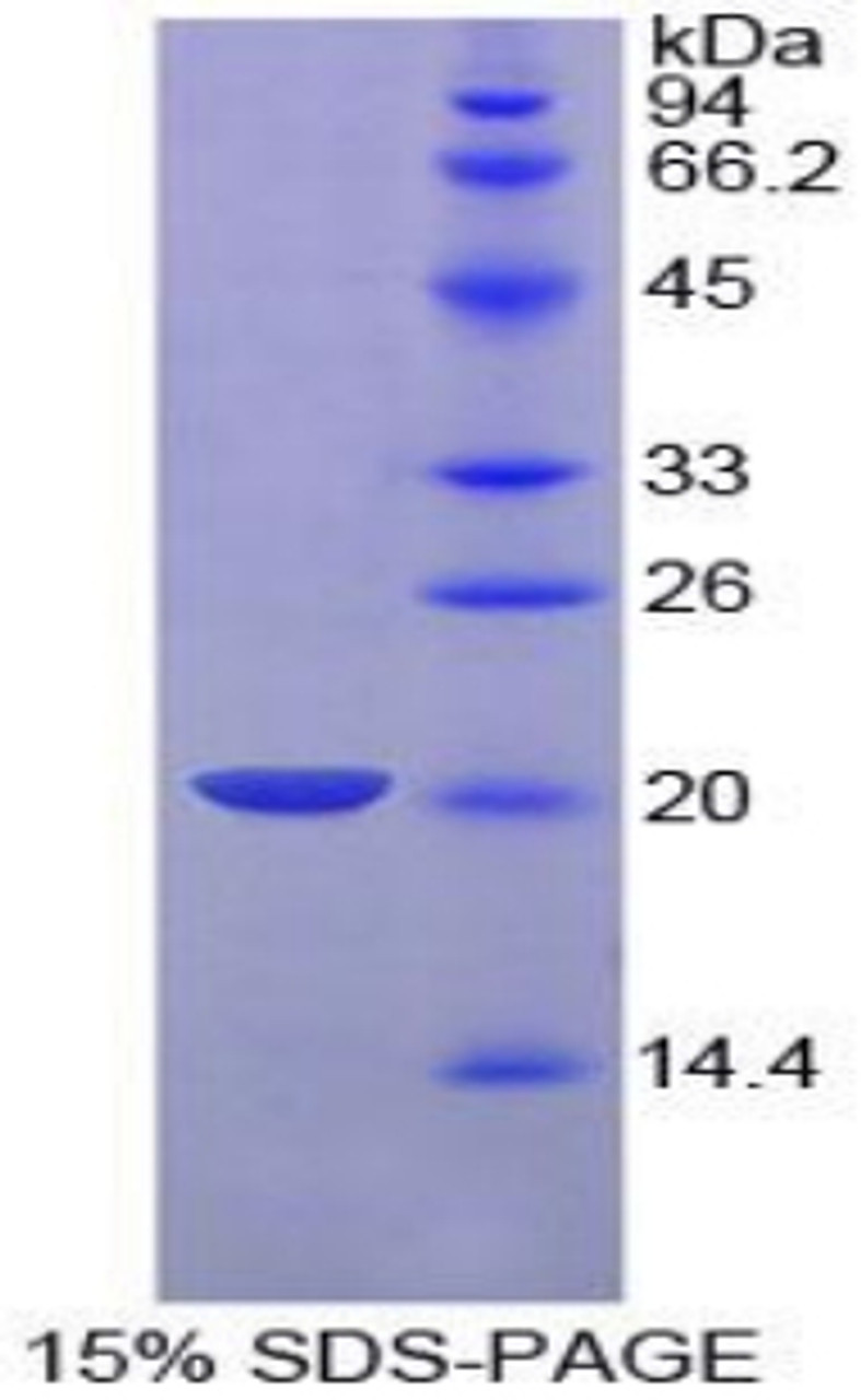 Pig Recombinant Plasminogen Activator, Urokinase (uPA)