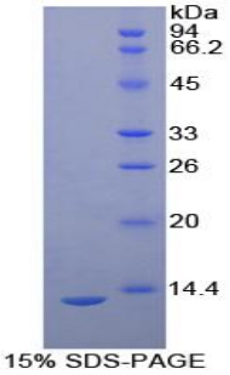 Human Recombinant Plasminogen Activator, Urokinase Receptor (uPAR)