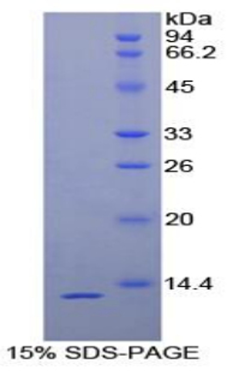 Human Recombinant Plasminogen Activator, Urokinase Receptor (uPAR)