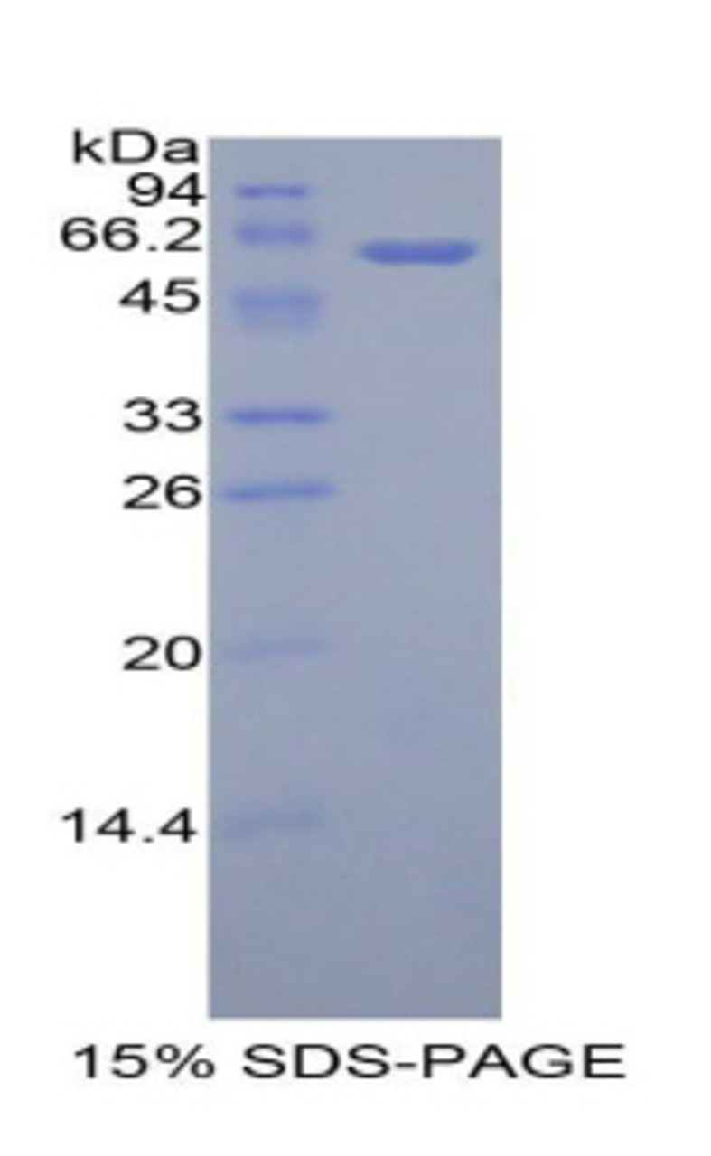 Human Recombinant Adiponectin Receptor 1 (ADIPOR1)