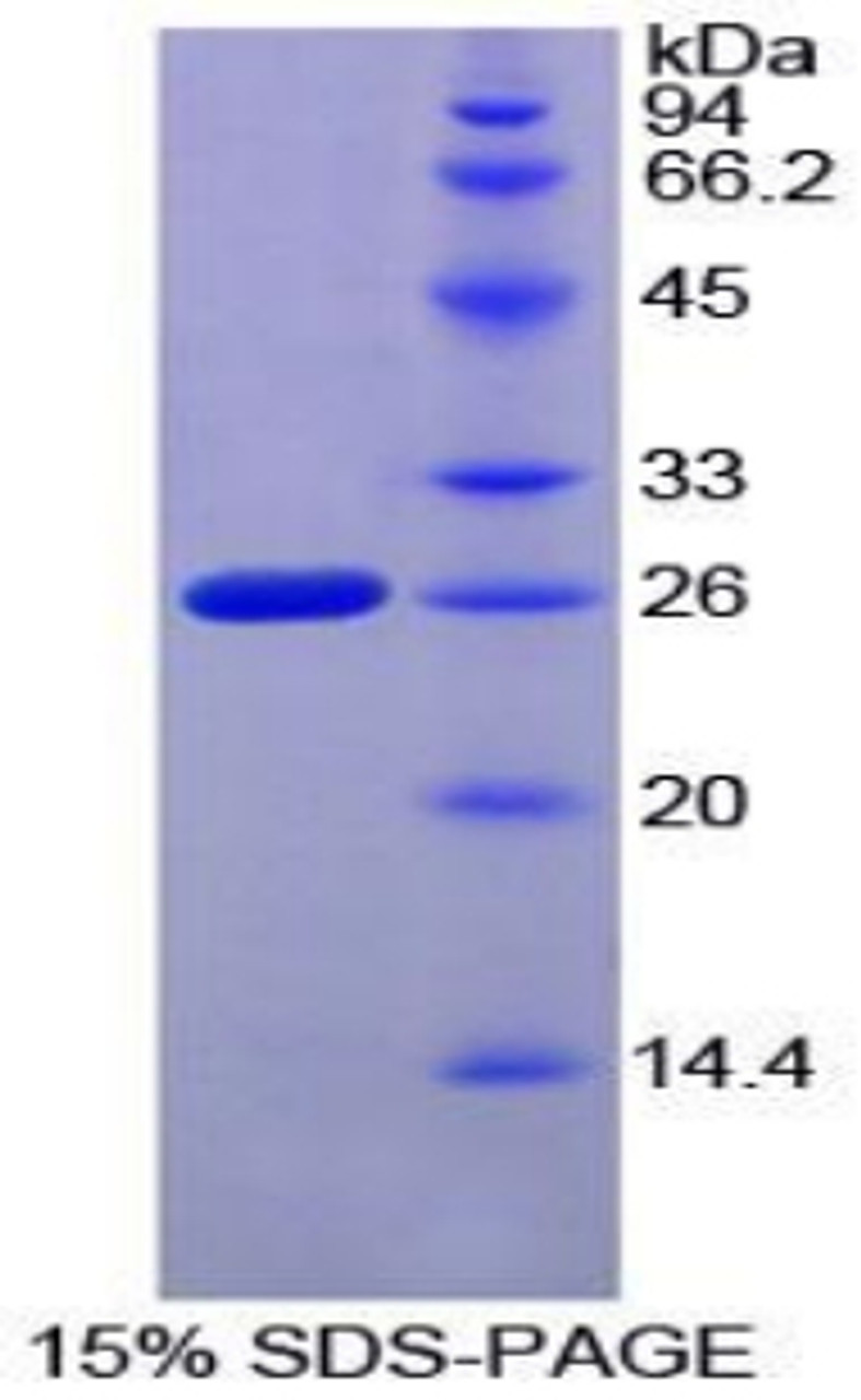 Mouse Recombinant Coagulation Factor VIII Associated Protein 1 (F8A1)