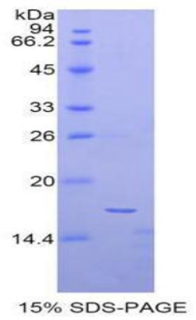 Human Recombinant Alpha-Fetoprotein (aFP)