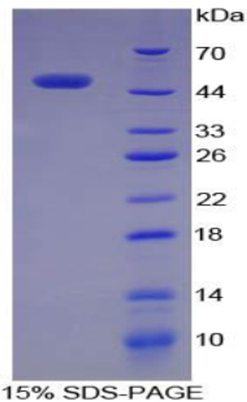 Pig Recombinant Alpha-Fetoprotein (aFP)