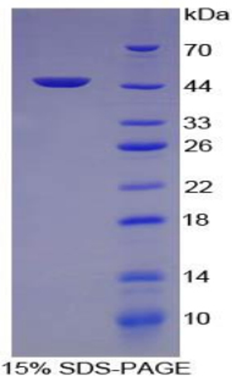 Pig Recombinant Alpha-Fetoprotein (aFP)