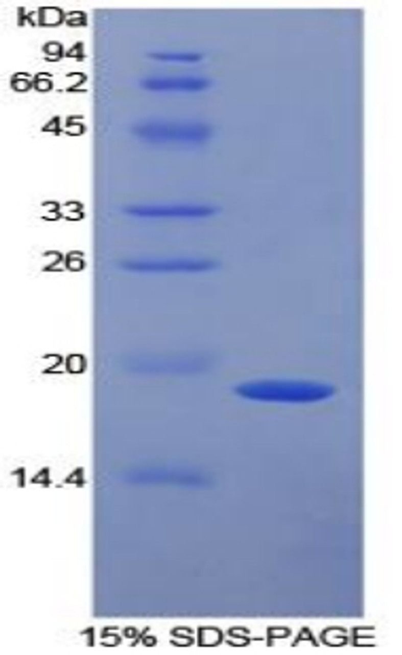 Mouse Recombinant Alpha-2-Plasmin Inhibitor (a2PI)