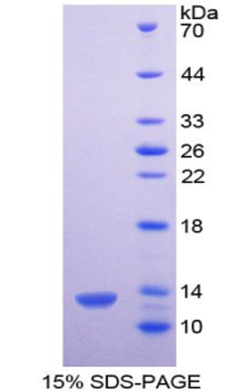 Mouse Recombinant Platelet Factor 4 (PF4)