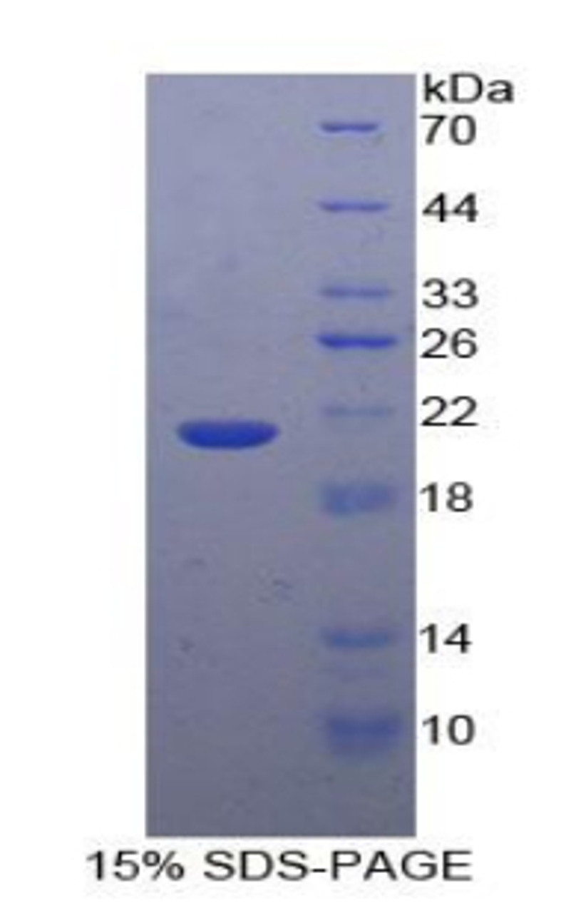 Human Recombinant Glucosidase Alpha, Acid (GaA)