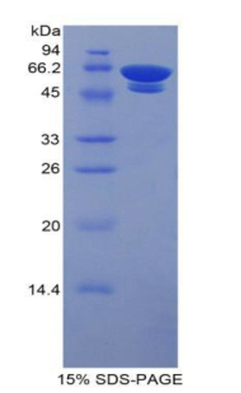 Human Native Glycated Hemoglobin A1c (HbA1c)