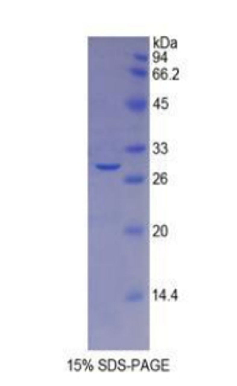 Mouse Recombinant Galactosidase Beta (GLb)