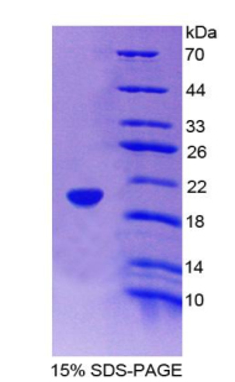 Rat Recombinant Fatty Acid Binding Protein 9, Testis (FABP9)