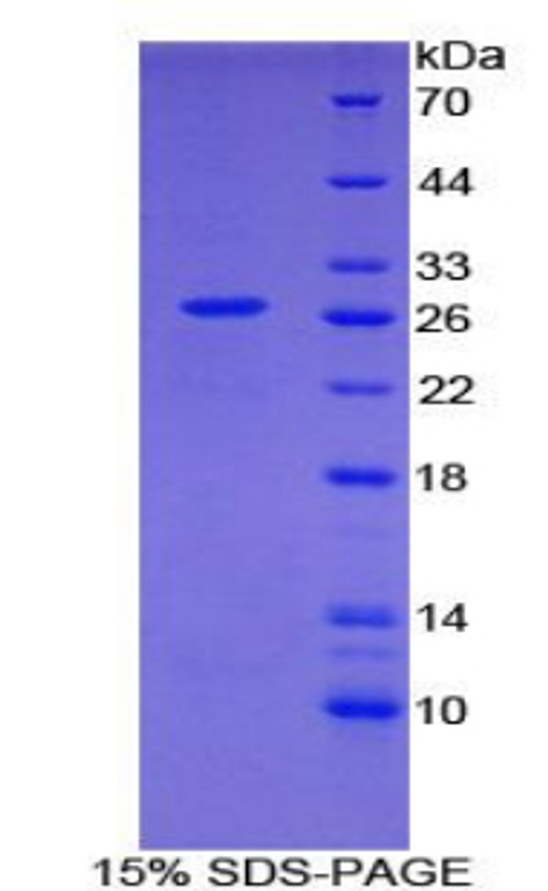 Human Recombinant Growth Arrest Specific Protein 2 (GAS2)