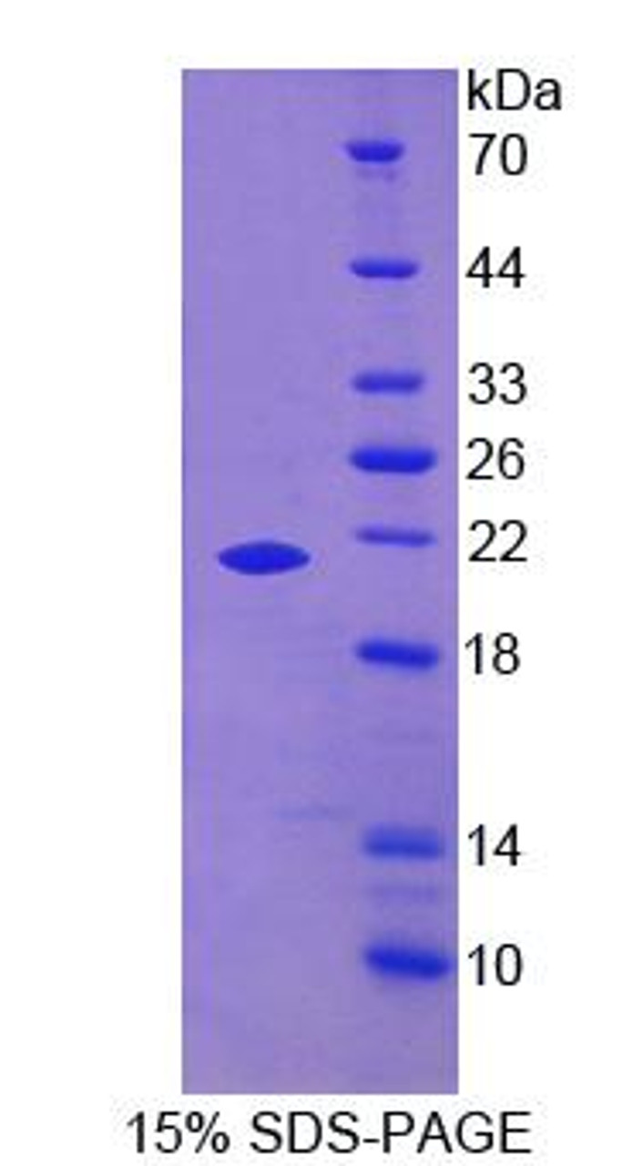 Human Recombinant Growth Arrest Specific Protein 6 (GAS6)