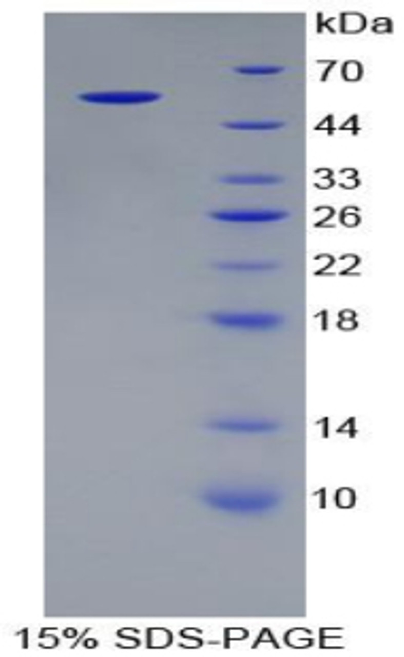 Rat Recombinant Alanine Aminotransferase (ALT)