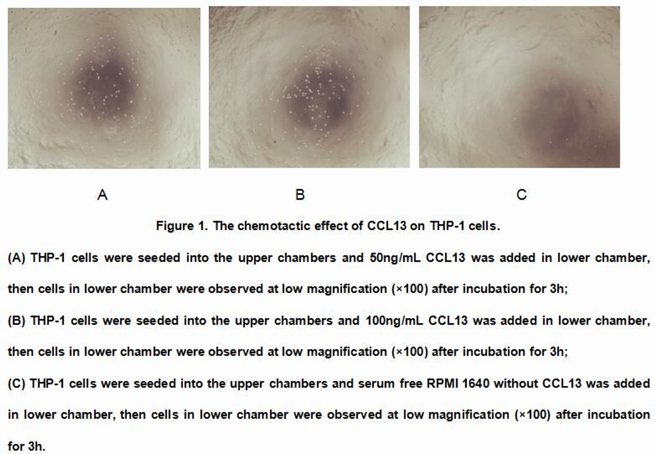 Human Active Monocyte Chemotactic Protein 4 (MCP4)