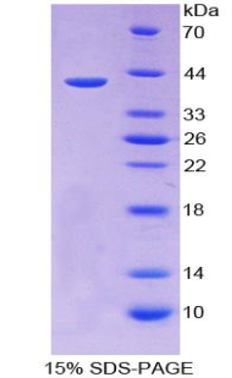 Human Recombinant Monocyte Chemotactic Protein 4 (MCP4)