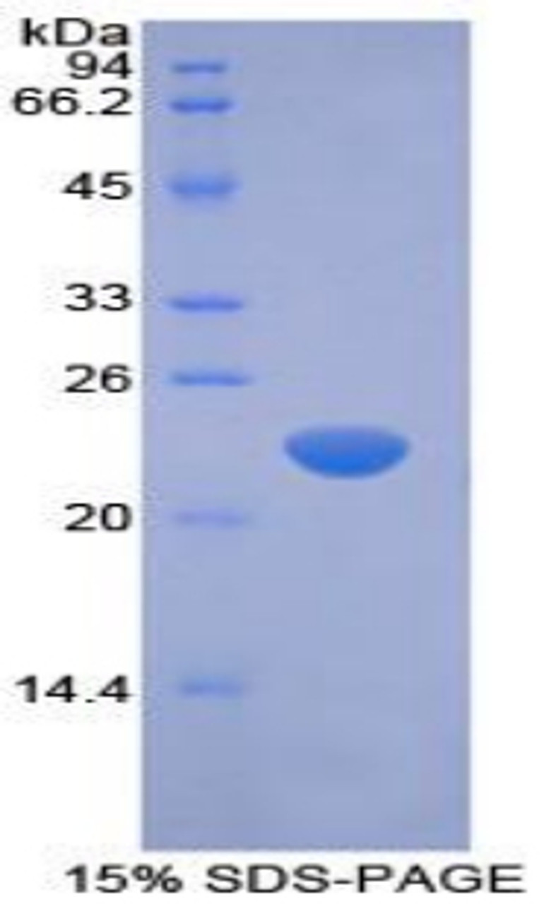 Rabbit Recombinant Interferon Beta (IFNb)