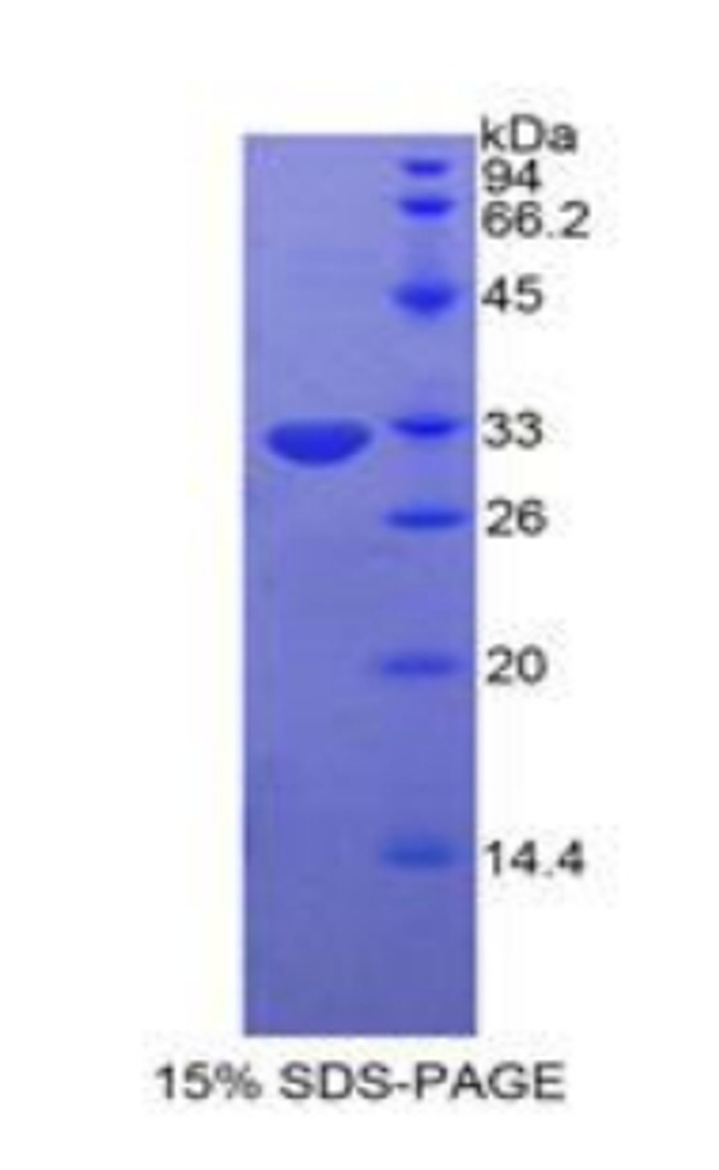 Human Recombinant Protein Kinase C Eta (PKCh)