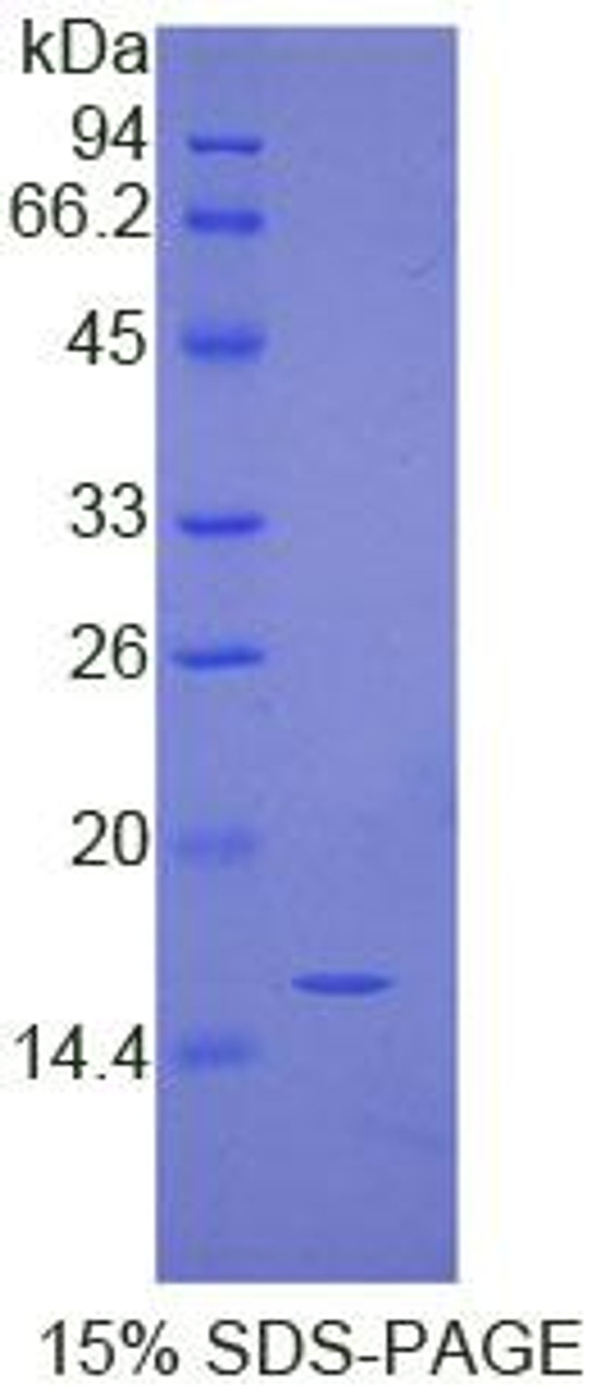 Human Recombinant Immunoglobulin G4 (IgG4)