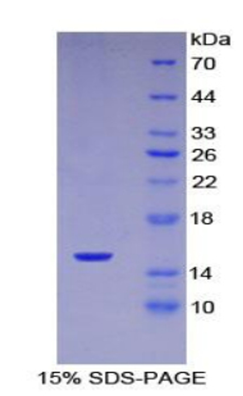 Mouse Recombinant Complement 1 Inhibitor (C1INH)