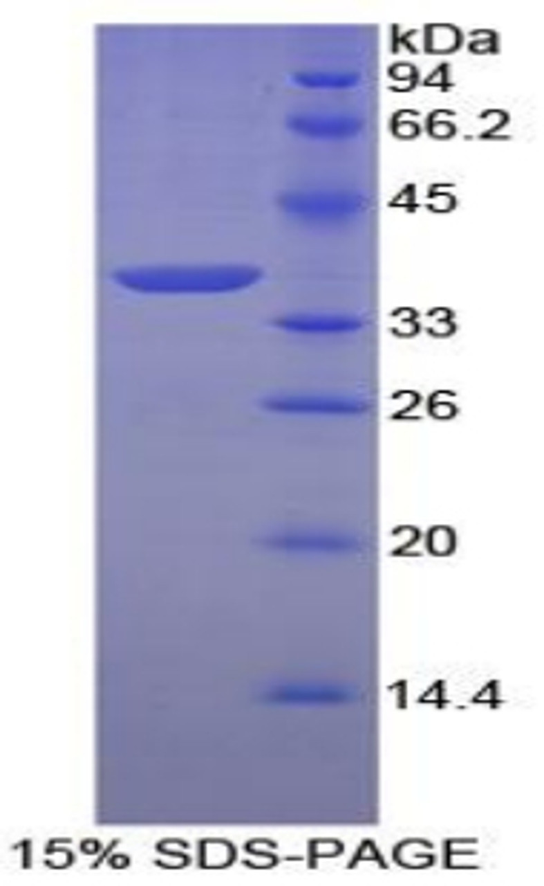 Chicken Recombinant Annexin A5 (ANXA5)