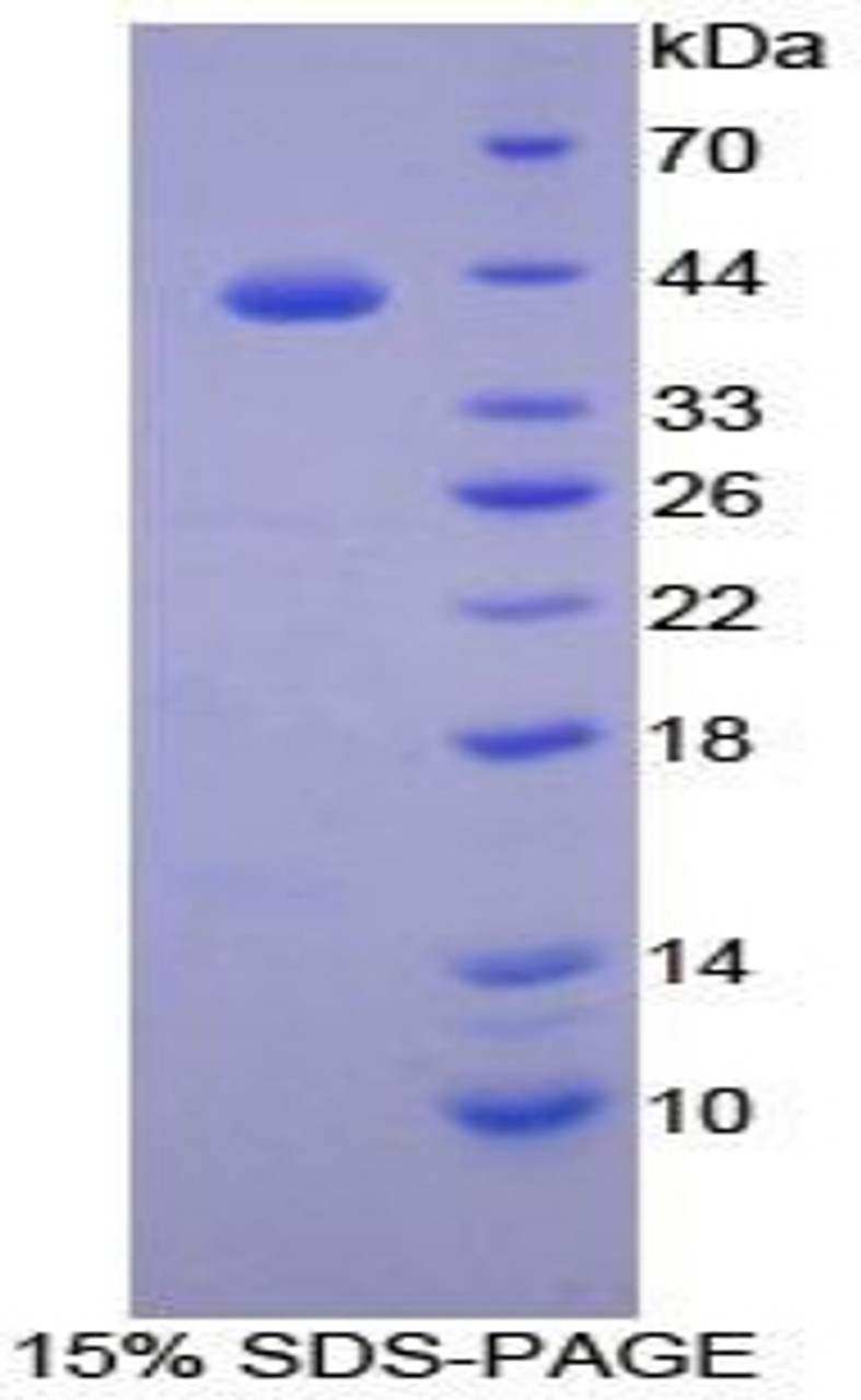 Human Recombinant Transferrin Receptor 2 (TFR2)