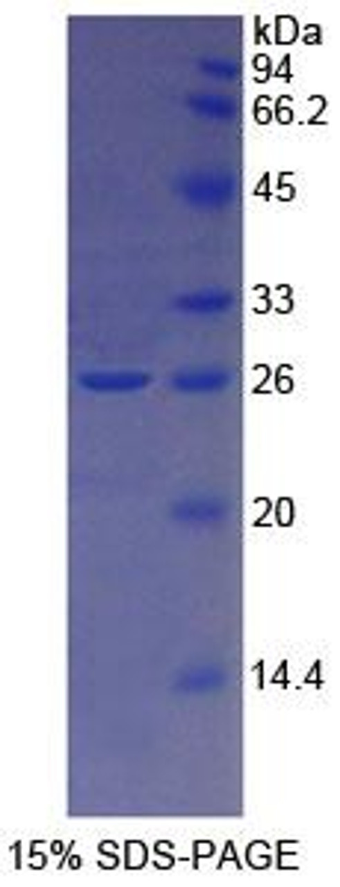 Human Recombinant Transferrin Receptor 2 (TFR2)