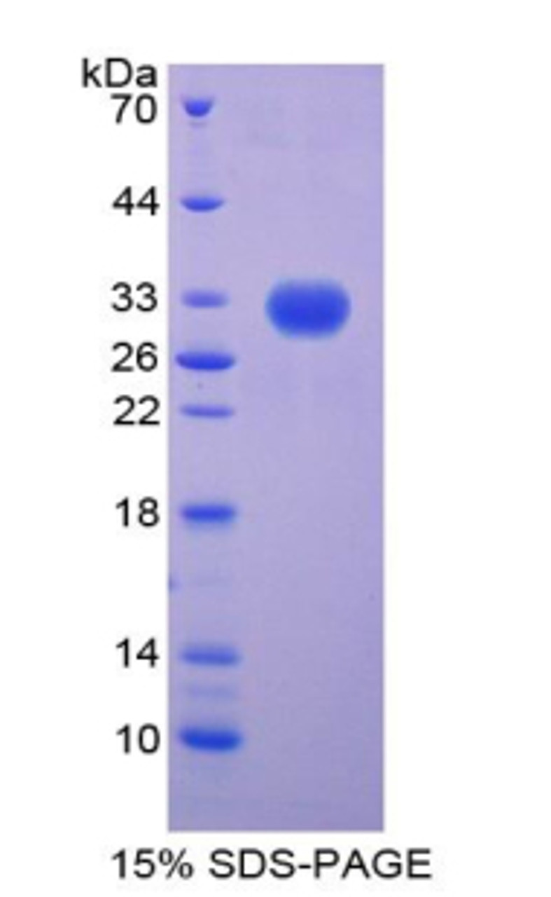 Human Recombinant Centromere Protein H (CENPH)