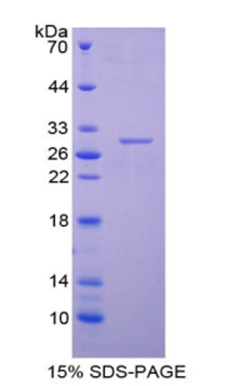 Mouse Recombinant Centromere Protein H (CENPH)