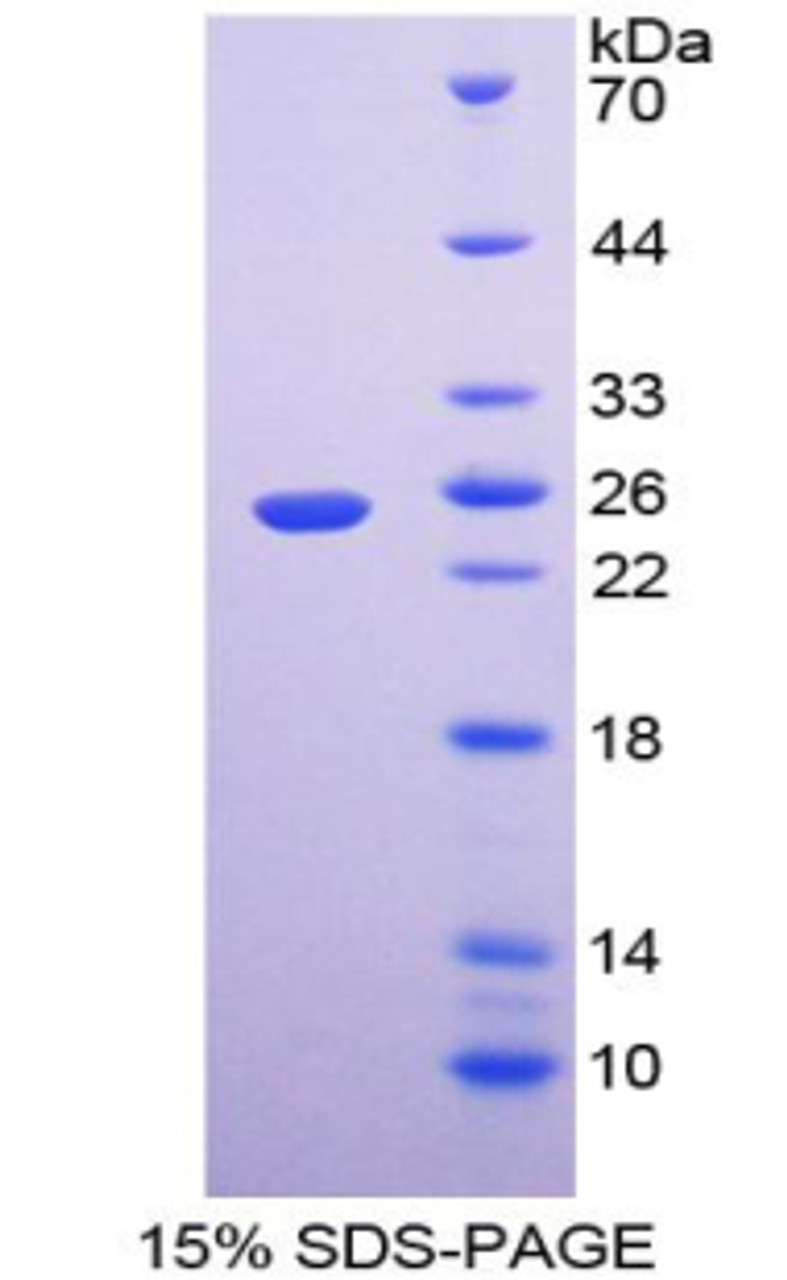 Human Recombinant Linker For Activation Of T-Cell (LAT)