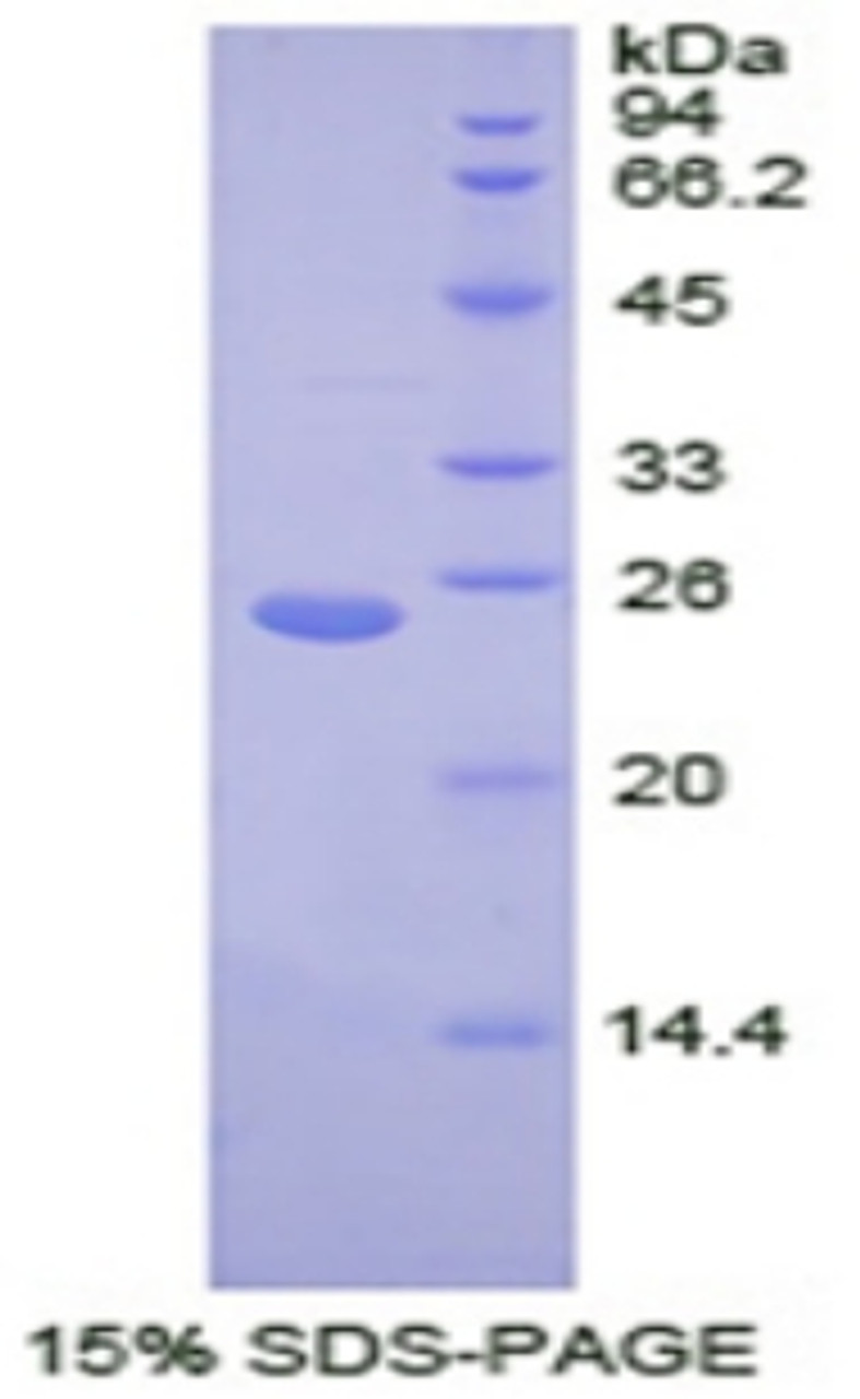 Human Recombinant Transportin 1 (TNPO1)