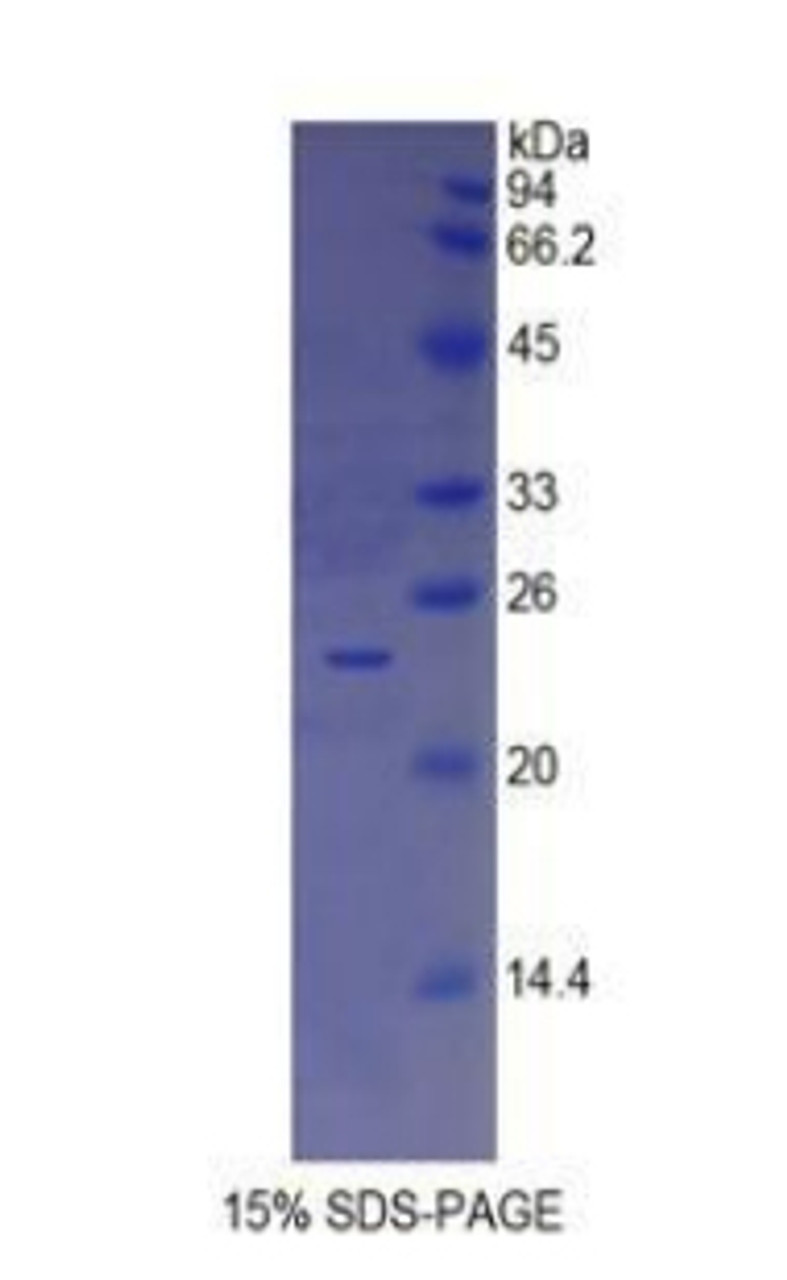 Human Recombinant Insulin Like Growth Factor Binding Protein 6 (IGFBP6)