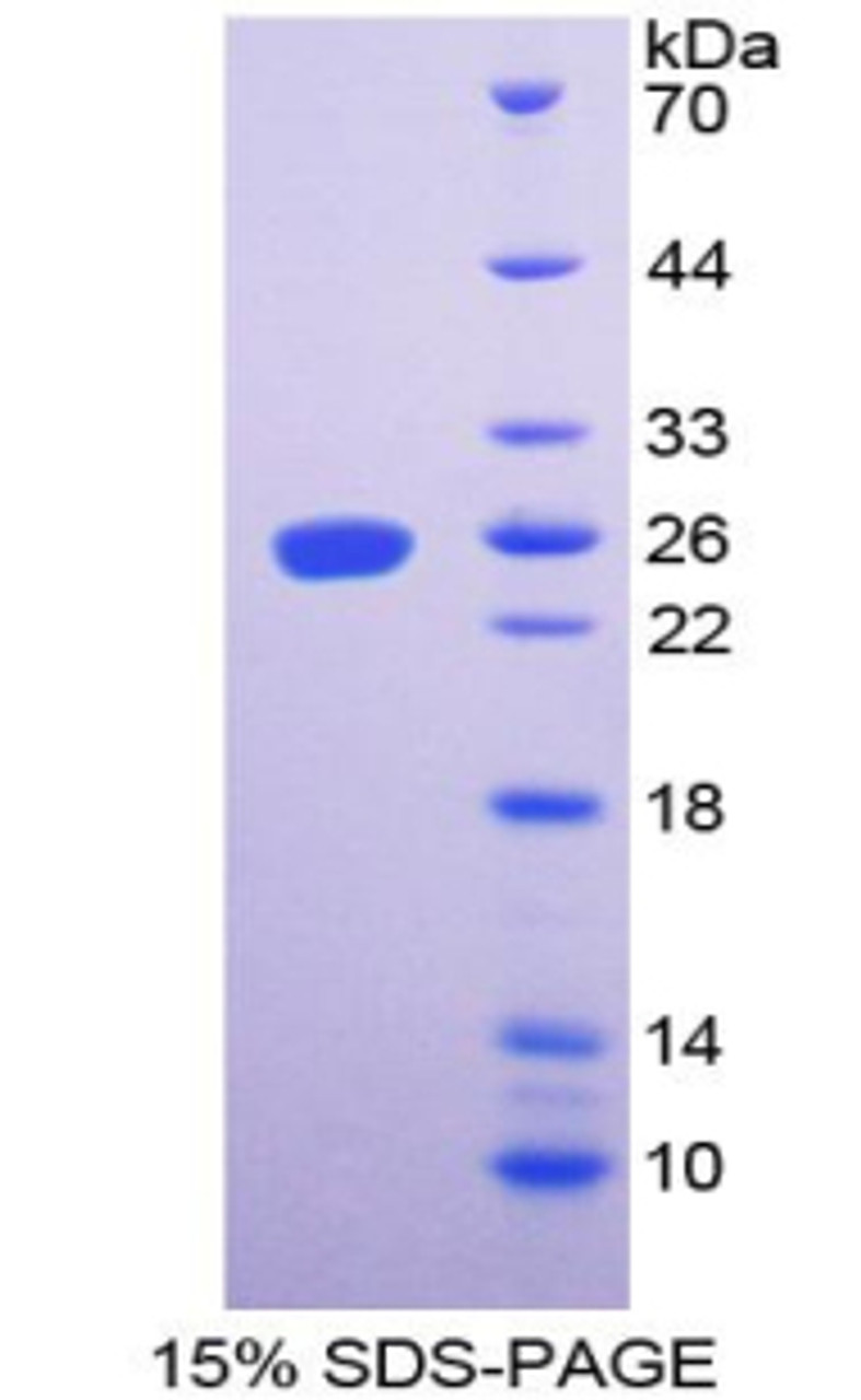 Rat Recombinant Talin (TLN)