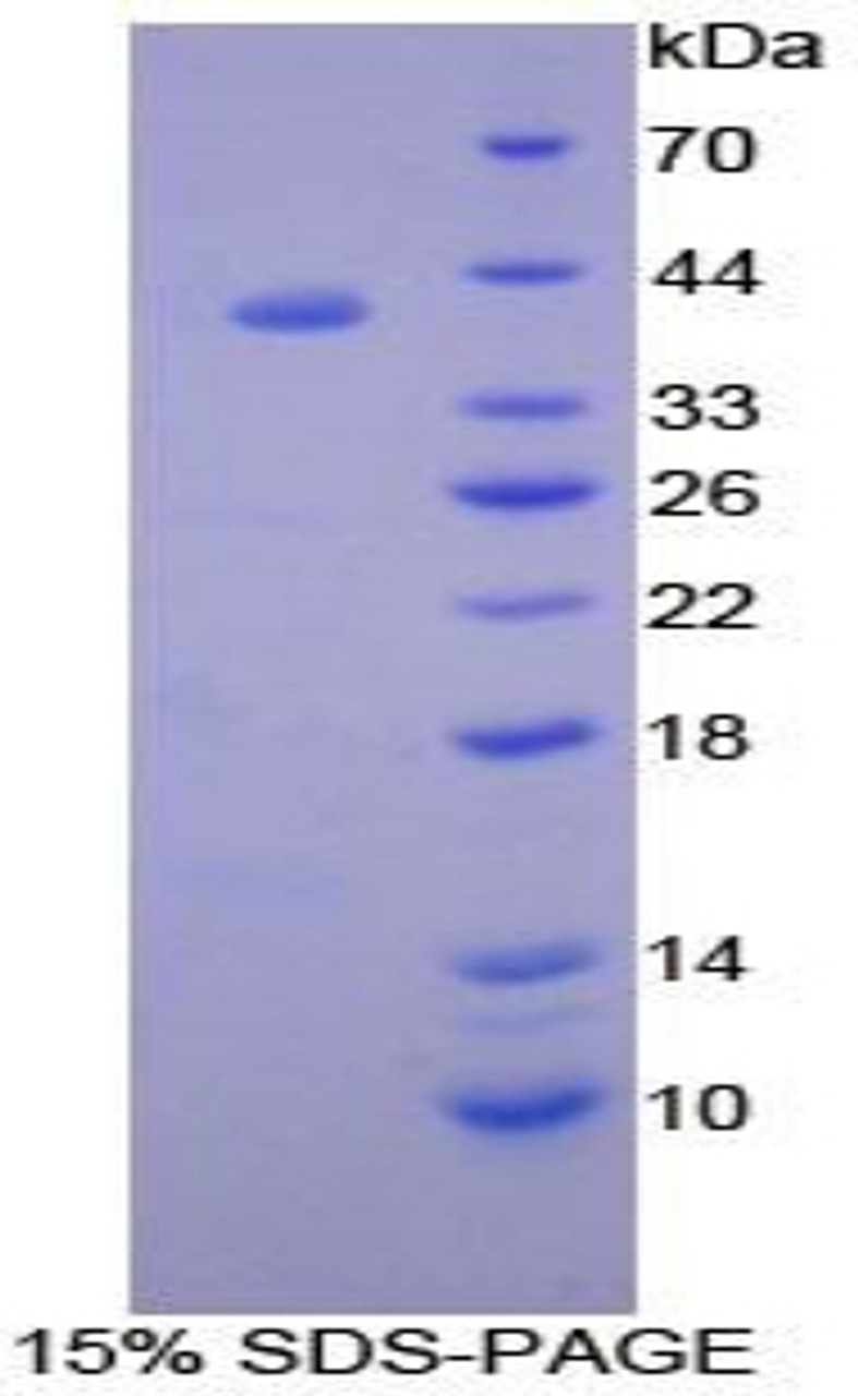 Human Recombinant B-Cell Activation Factor Receptor (BAFFR)