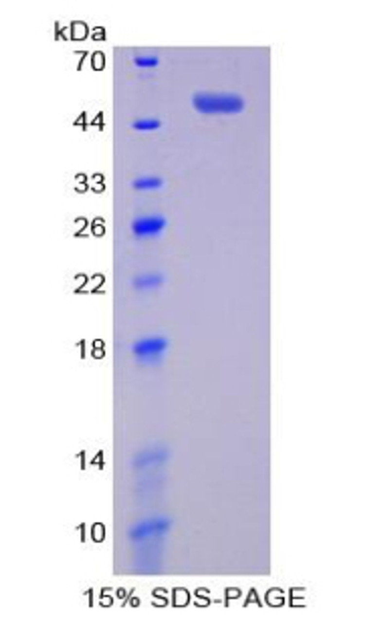 Rat Recombinant B-Cell Activation Factor Receptor (BAFFR)