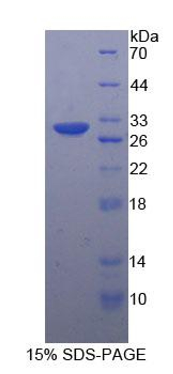 Human Recombinant Heparin Cofactor II (HCII)