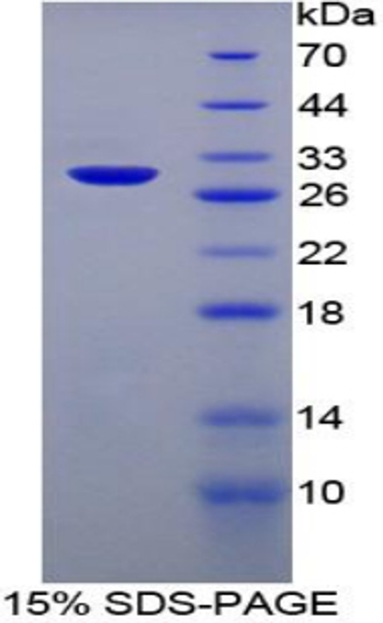 Rat Recombinant Heparin Cofactor II (HCII)