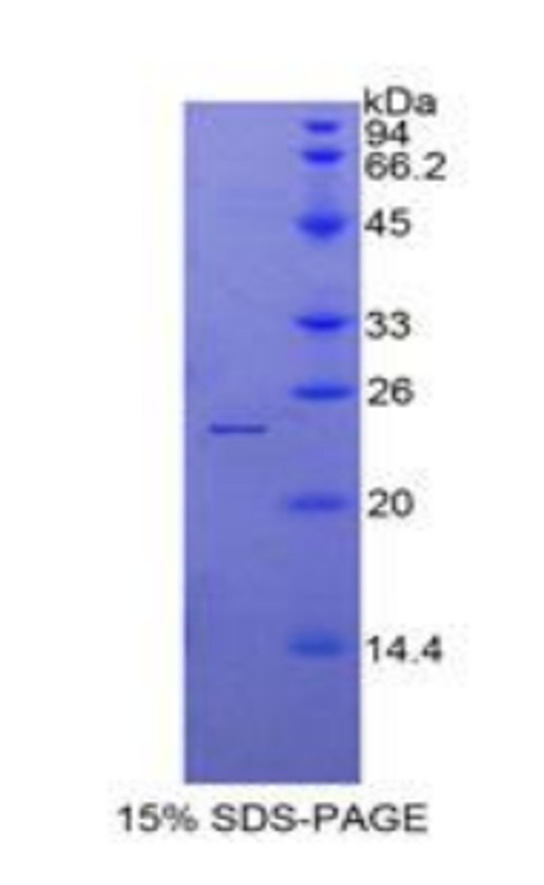 Chicken Recombinant Alpha-Fodrin (SPTAN1)