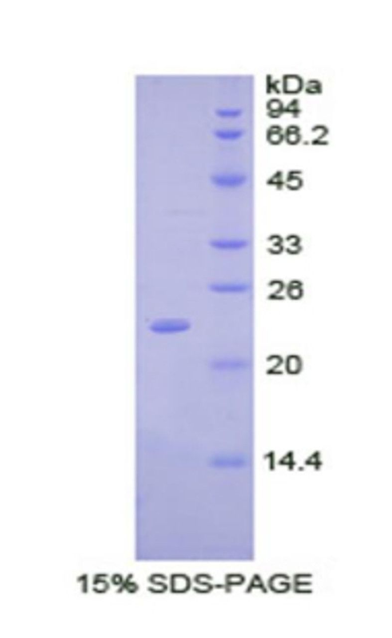 Chicken Recombinant Alpha-Fodrin (SPTAN1)