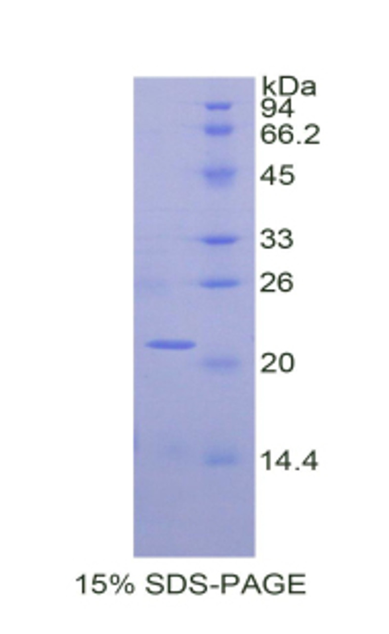 Mouse Recombinant Alpha-Fodrin (SPTAN1)