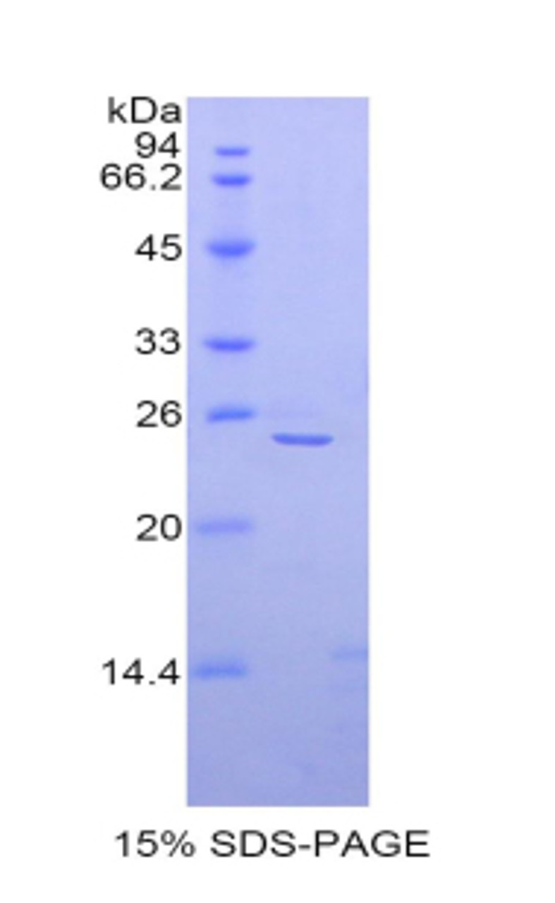 Mouse Recombinant Alpha-Fodrin (SPTAN1)