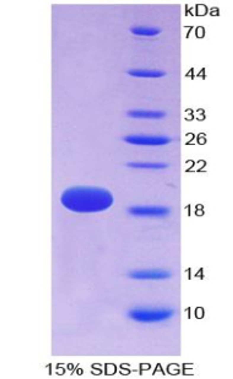 Rat Recombinant Alpha-Fodrin (SPTAN1)