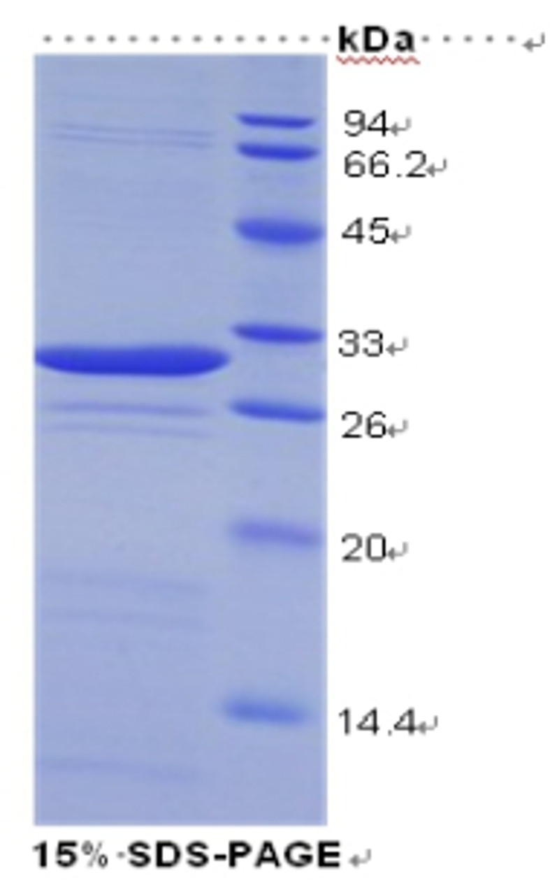 Human Recombinant Galectin 3 (GAL3)