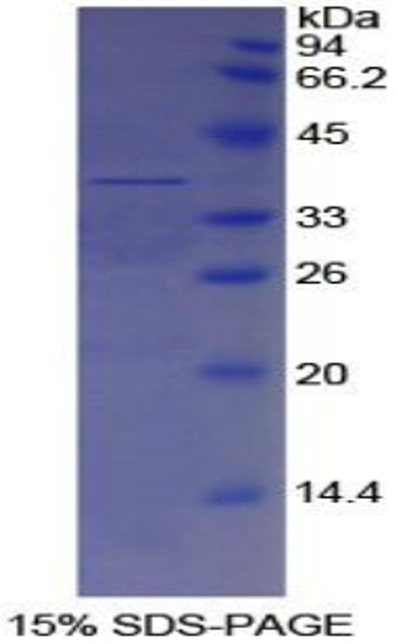 Human Recombinant Apolipoprotein H (APOH)